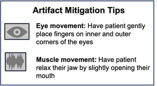 Artifact mitigtation tips