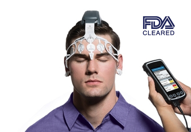 Accurate Concussion Testing with BrainScope